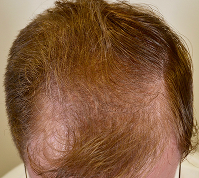 Before transformation