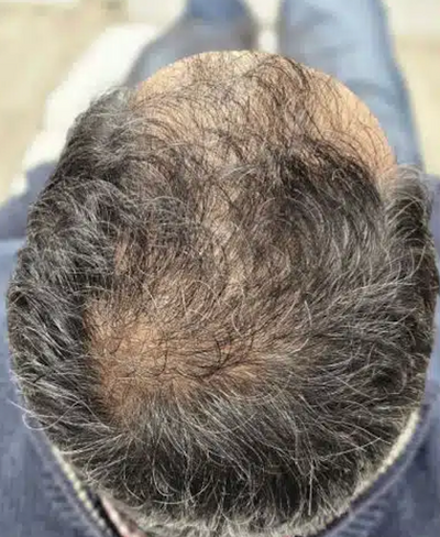 Before transformation