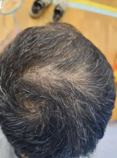 After transformation