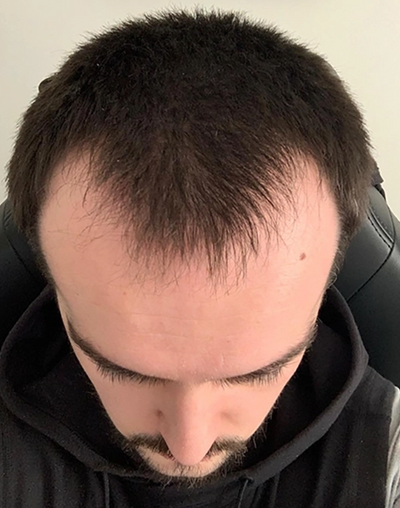 Before transformation