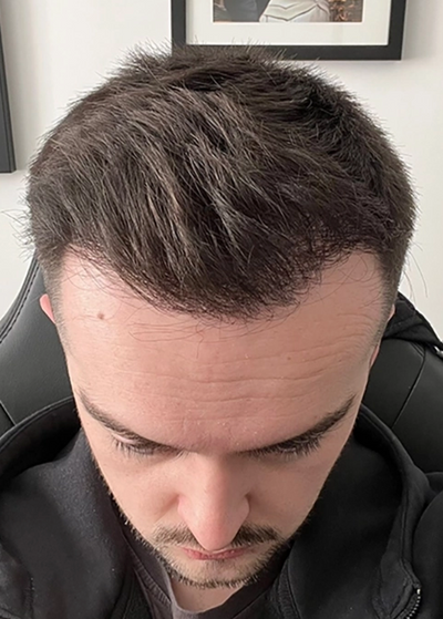 After transformation