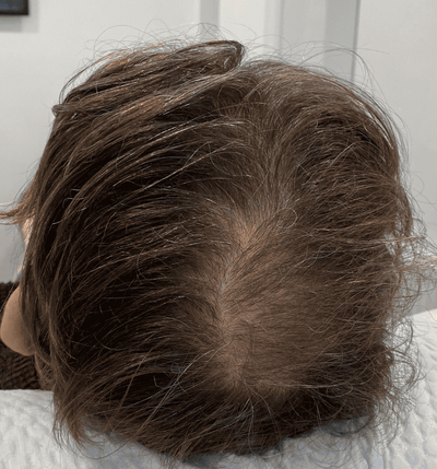 After transformation