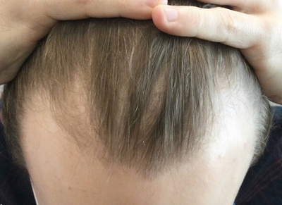 Before transformation