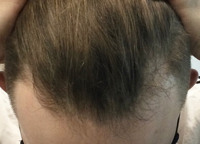 After transformation