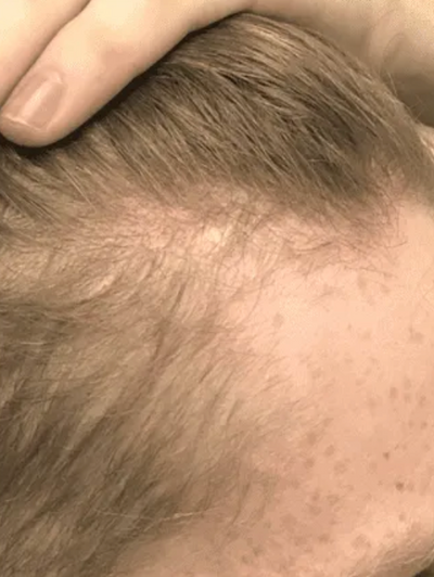 Before transformation