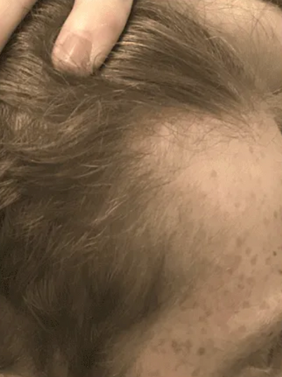 After transformation